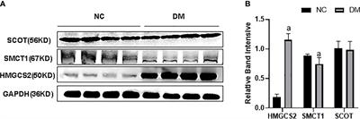 Hyperinsulinemia impairs the metabolic switch to ketone body utilization in proximal renal tubular epithelial cells under energy crisis via the inhibition of the SIRT3/SMCT1 pathway